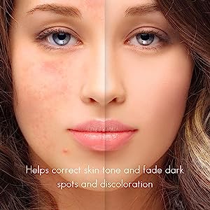 Clear Balance Saargol Dark Spot Remover Serum - Fade Acne