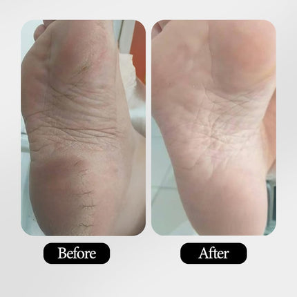 Keywords on a browser displaying Mitchell USA Anti-aging Foot Cream, recognized as a leading deep nourishing foot cream designed to soften and rejuvenate feet.