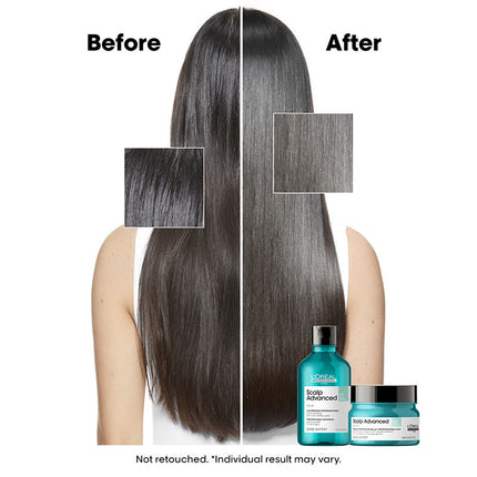 L'Oreal Scalp Advanced Anti-Oiliness Clay 3