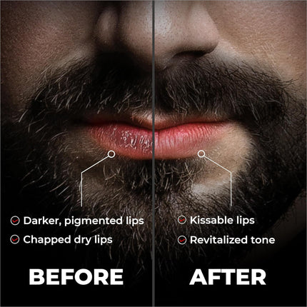 Beardo Lip Lightener for Men 7g | Non Tinted Lip Balm