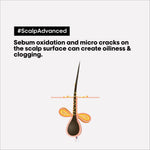L’Oréal Professionnel Scalp Advanced Anti-Discomfort
