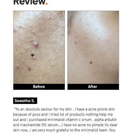 Minimalist Vitamin C 10% Face Serum official customer review