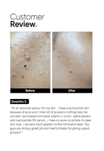 Minimalist Vitamin C 10% Face Serum official customer review