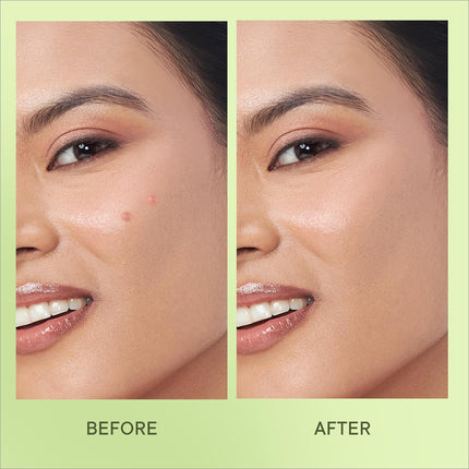 Application guide of Quench Zit Away Acne Pimple Patches, demonstrating how to use them effectively on your skin.