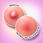 Recode Acne Patch Pack Of 36 Patches product image 4