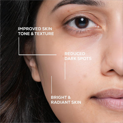 A close-up of a woman’s face showing improved skin tone and radiance using renee everyday face bright illuminating serum