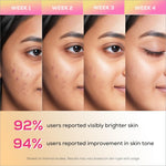 Four-week skincare transformation showing renee everyday face bright illuminating serum improving brightness and tone