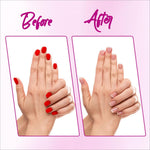 Close-up view of RENEE Nail Paint Remover Wipes, emphasizing acetone-free formula for gentle and effective nail polish removal.