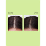 Before and after results of using Quench's Scalp Scrub for Dandruff, emphasizing its effectiveness in treating dandruff.