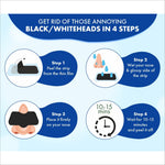 Urban Yog Nose Strips (4 Strips) Black/Whitehead Remover